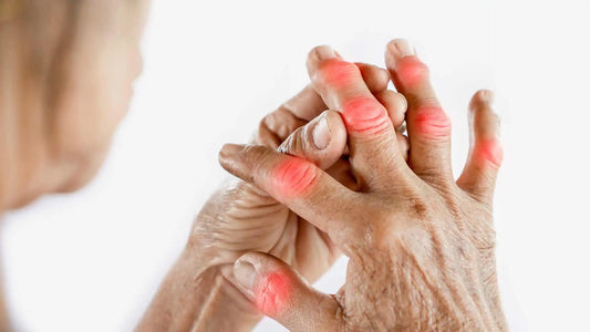 Cómo cuidar tus articulaciones de forma natural según la ciencia